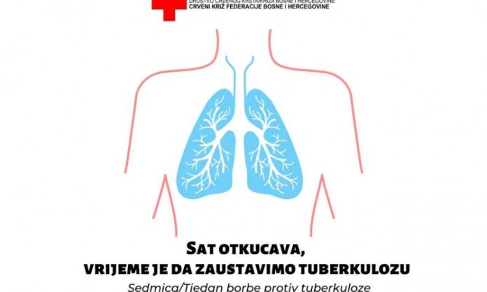 sedmica borbe protiv tuberkuloze 2021