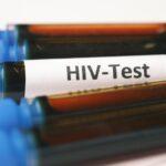 HIV Ilustracija