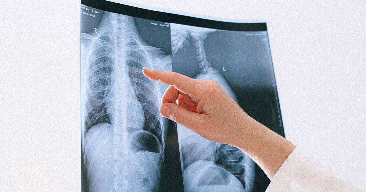 pluca Skupština TK odobrila izmjene Finansijskog plana ZZO TK, uvedena ABA terapija