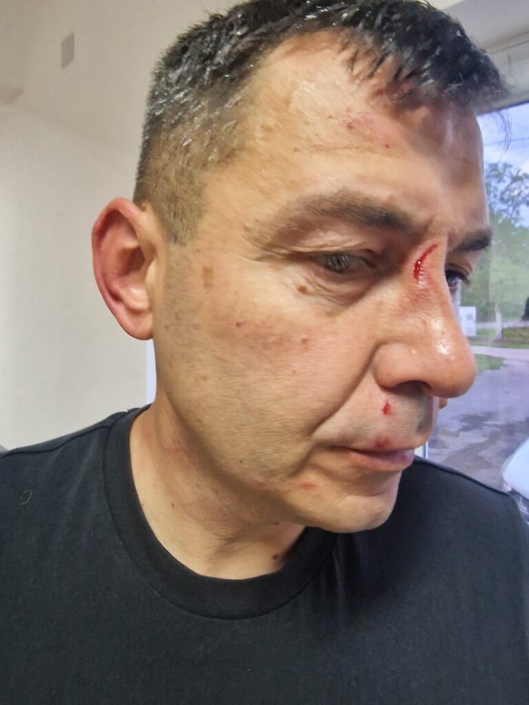 Skandal, bh fudbal