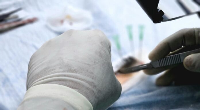 Kineski ljekari izveli prvu transplantaciju svinjske jetre čovjeku Kineski ljekari izveli prvu transplantaciju svinjske jetre čovjeku