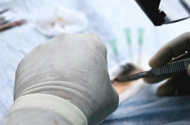 Kineski ljekari izveli prvu transplantaciju svinjske jetre čovjeku
