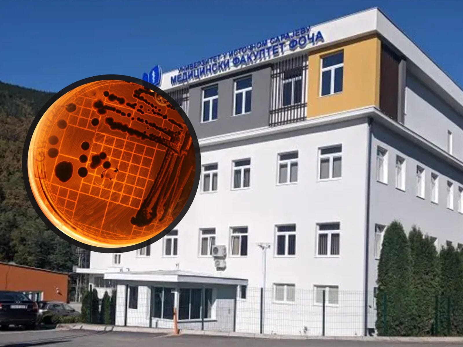 Kod studentice iz Indije koja studira u Foči potvrđen trbušni tifus