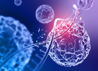 Revolucionarna terapija poništila agresivne karcinome krvi kod pacijenata