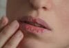 Ispucale usne mogu biti znak ozbiljnog nedostatka u organizmu