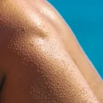 Zašto se ježimo, odgovor koji krije tijelo i nosi tragove naših predaka