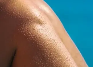 Zašto se ježimo, odgovor koji krije tijelo i nosi tragove naših predaka Zašto se ježimo, odgovor koji krije tijelo i nosi tragove naših predaka