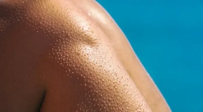 Zašto se ježimo, odgovor koji krije tijelo i nosi tragove naših predaka