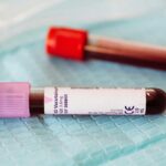 Otkrivena izuzetno rijetka mutacija krvi B(A): Novo saznanje koje mijenja transfuzijsku medicinu Otkrivena izuzetno rijetka mutacija krvi B(A): novo saznanje koje mijenja transfuzijsku medicinu