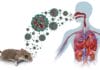 Hantavirus