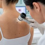 Besplatni pregledi kože i pregled mladeža kod dermatologa