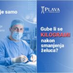 Koliko kilograma možete izgubiti nakon smanjenja želuca?