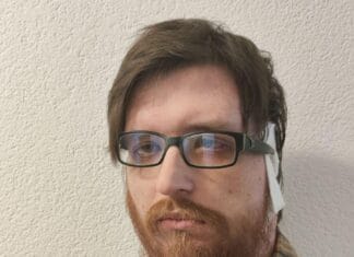 Jasenko Ramić iz Tuzle ponovo treba pomoć: Za operaciju potrebno 58.675 KM